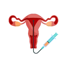 Intrauterine Insemination IUI Treatment Icon